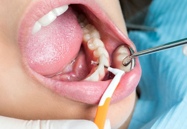 Best Dental Clinic in Vaishali Nagar