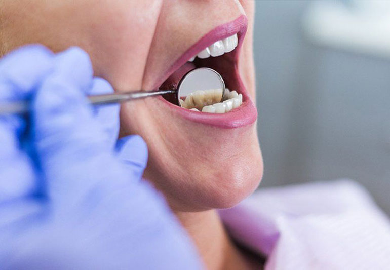 Best Dental Clinic in Bhankrota